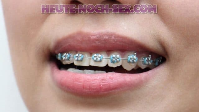 Frau mit Zahnspange hat Lust auf dicke Schwänze Hast du Bock auf eine frau mit Zahnspange?